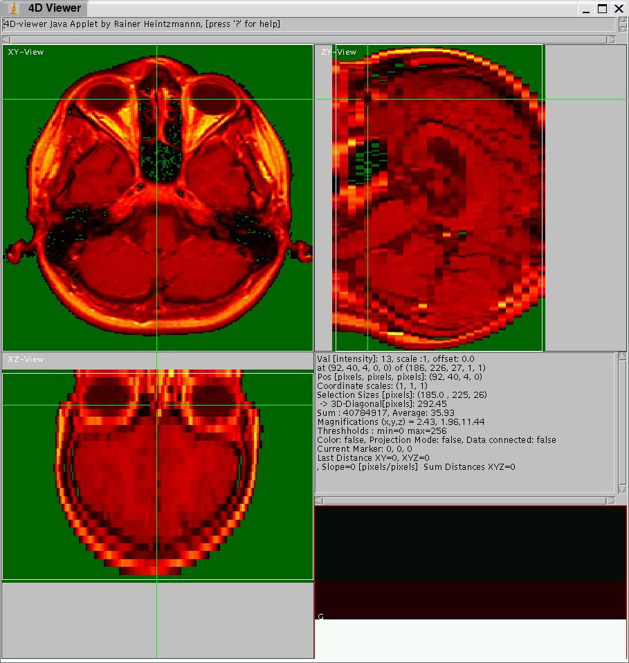 Example displaying an MRI dataset