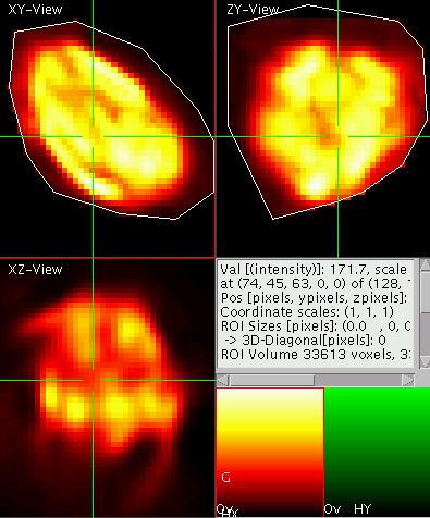 Orthogonal ROI and the projections